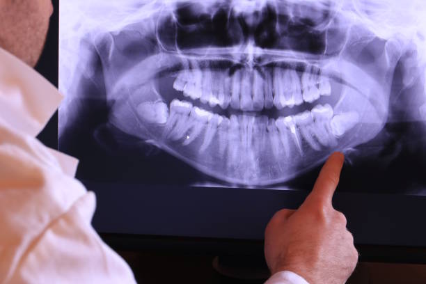 Best Emergency Cosmetic Dentistry in Yadkinville, NC