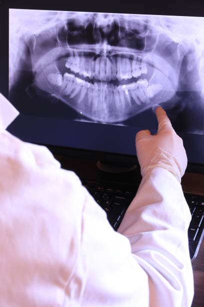 Best Emergency Dentist for Special Needs Patients in Yadkinville, NC
