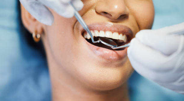 Best Emergency Dentist for Lost Fillings or Crowns in Yadkinville, NC